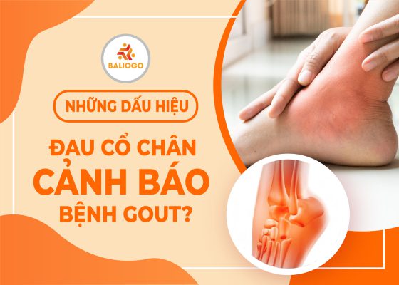 Những dấu hiệu Đau cổ chân cảnh bảo bệnh Gout?